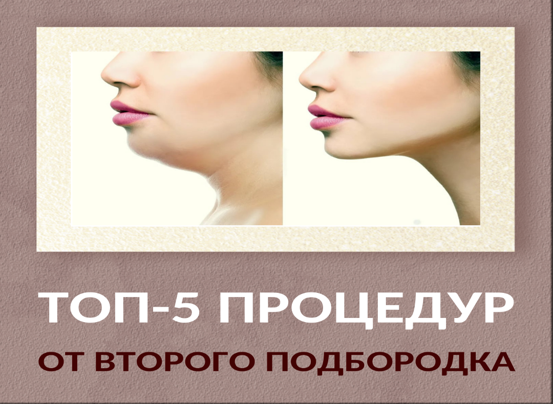 Топ-5 процедур от второго подбородка❗