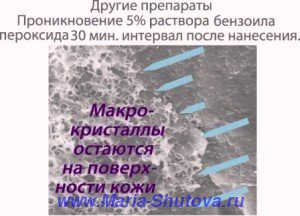 Макрокристаллы на поверхности кожи